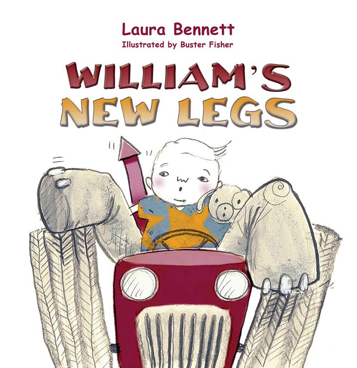 William&#x27;s New Legs