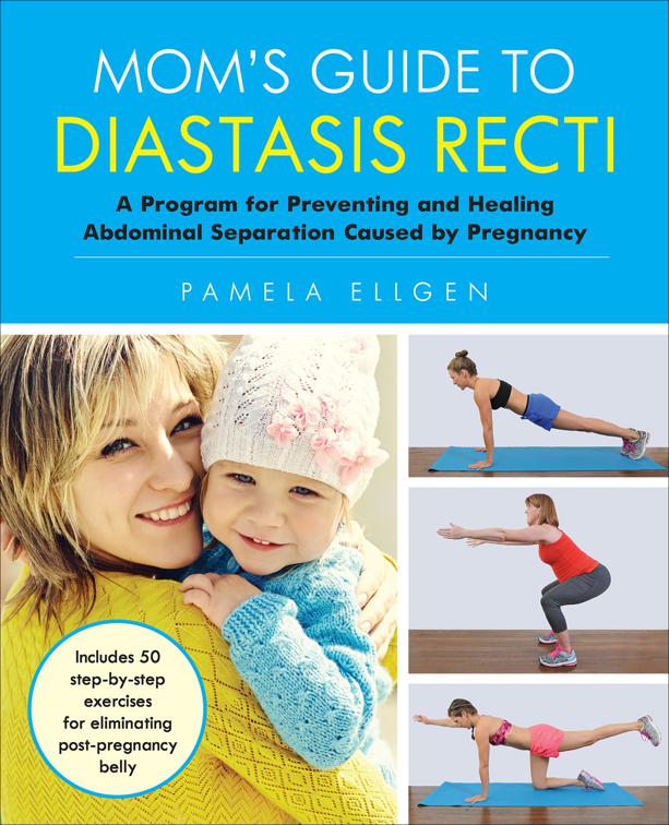 Mom&#x27;s Guide to Diastasis Recti